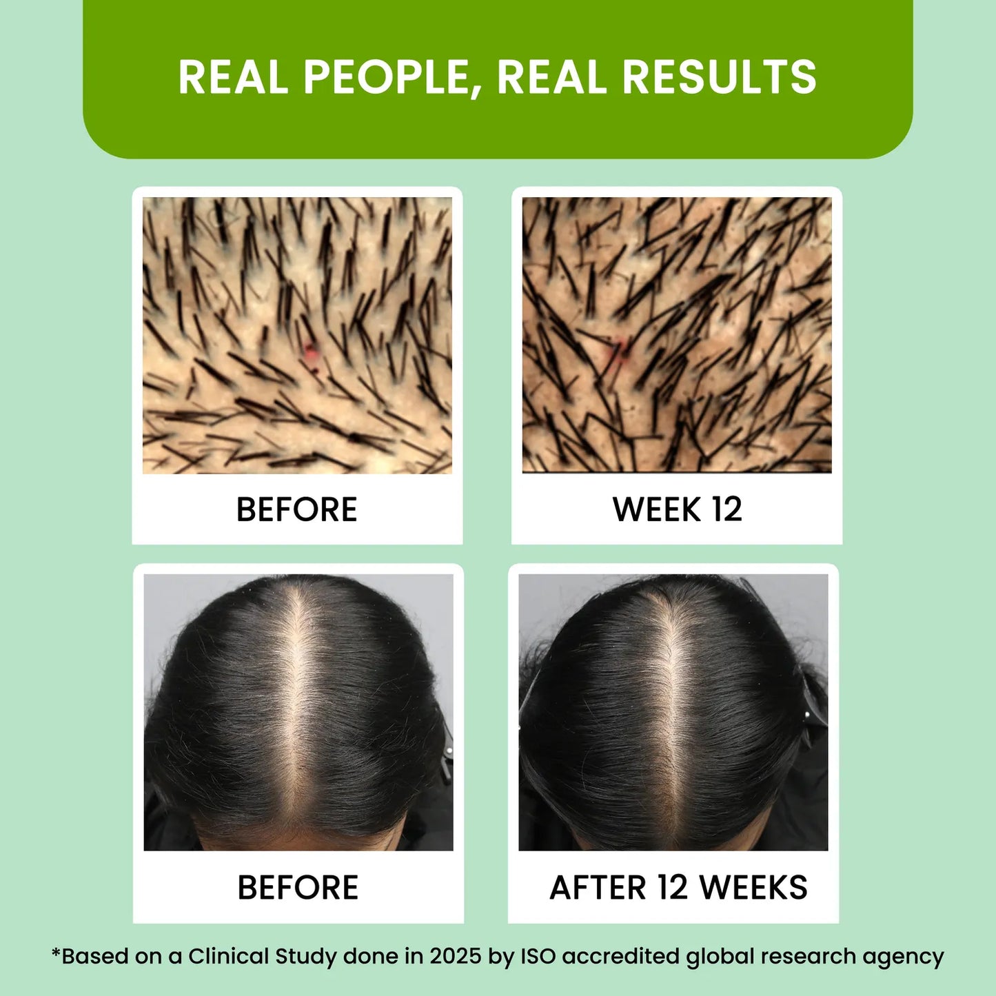 Alps Goodness Rosemary Water 100 ml) | Rosemary water for hair | Hair Spray for Regrowth | Hair Growth Expert | Viral Rinse
